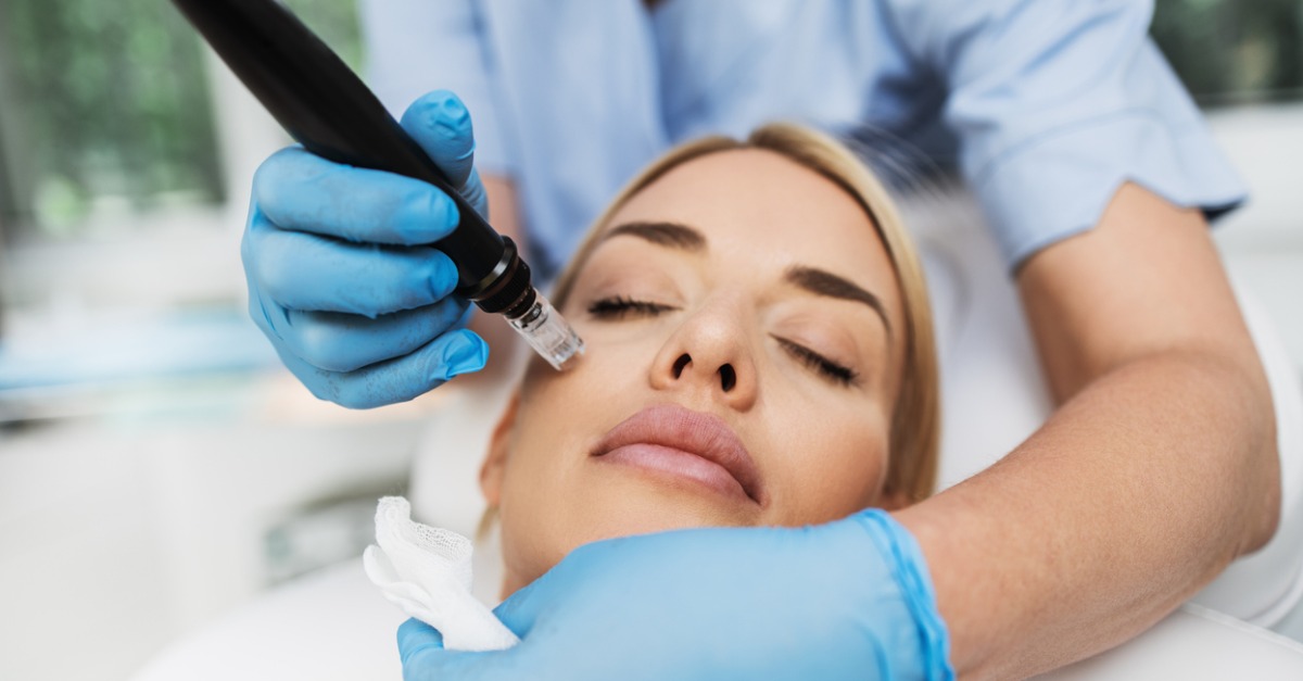 Explaining the PRP Microneedling Facial