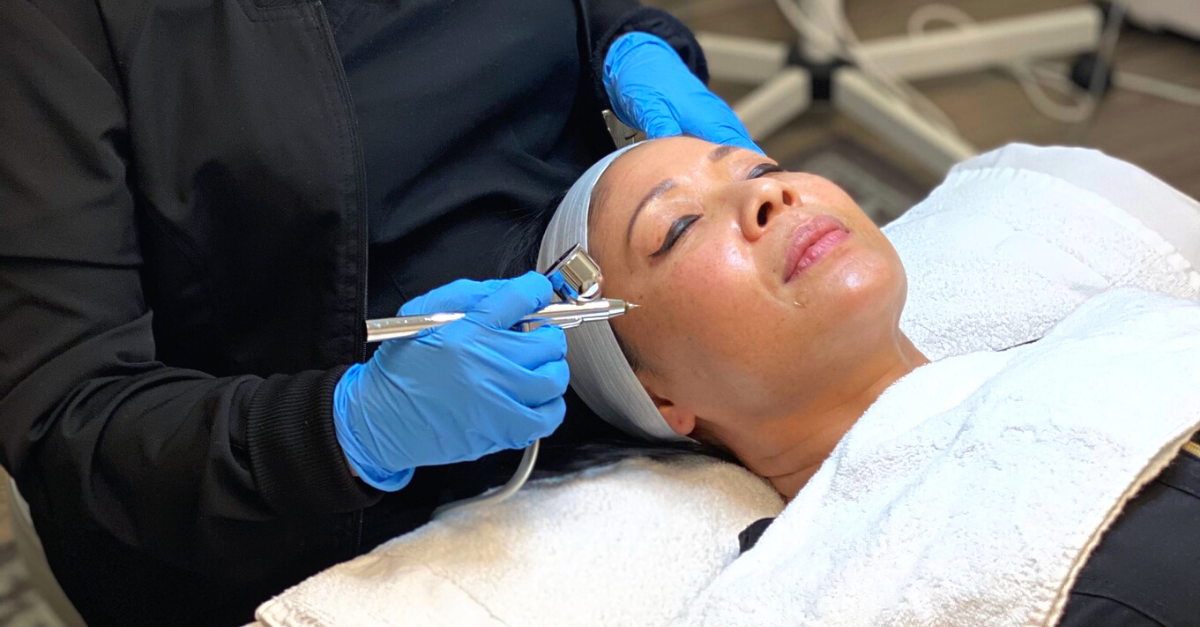 Aesthetic Treatments for Rosacea