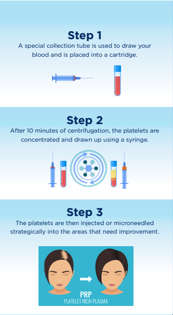 Hair loss procedure process graphic