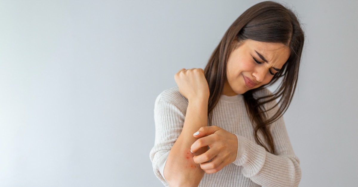 Different Types of Psoriasis
