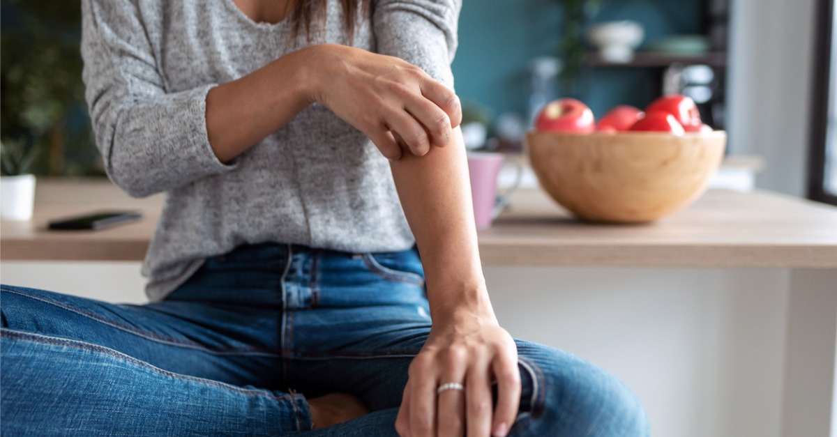 Common Eczema Myths