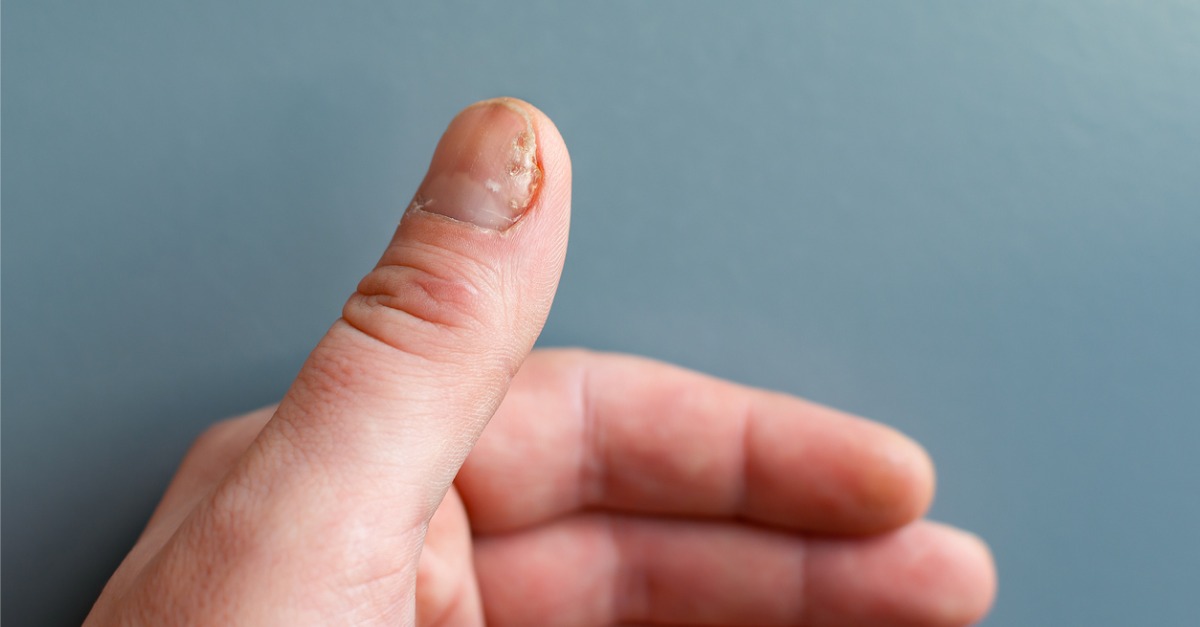 I learned an important lesson from my son's nail infection | by Pardeep  Goyal | Medium