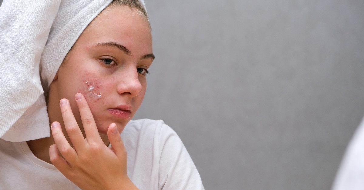 A Dermatologist’s Guide to Managing Accutane Side Effects in the Summer