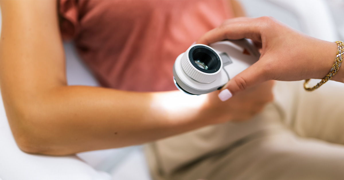 The Different Types of Skin Cancer and How to Treat Them