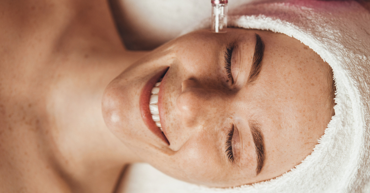 Your Guide to Microneedling This Spring