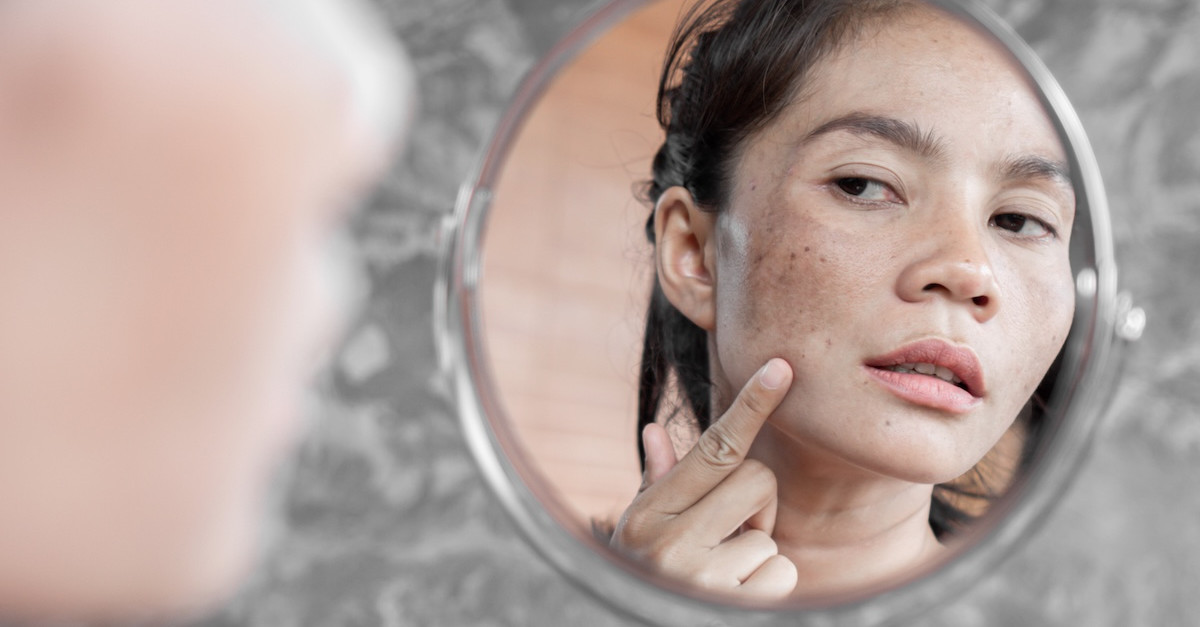 Woman looking in mirror examining her marks on face